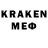 КЕТАМИН ketamine Sevil Mehtiyeva